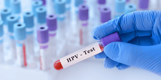 Hand im blauen Handschuh hält ein Reagenzglas mit „HPV-Test“, dahinter mehrere unscharfe Probenröhrchen im Labor Hintergrund