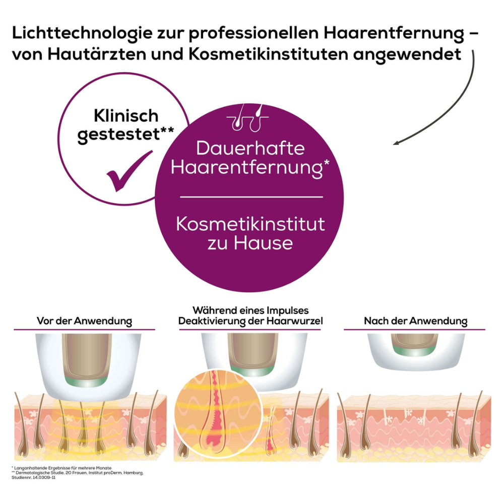 En tysk infografik om hårborttagningsteknologi med Beurer Permanent hårborttagning IPL VelvetSkinPro Black illustrerar processen före, under och efter användning. Texten betonar professionell permanent hårborttagning för hemmabruk, testad av hudläkare och kosmetikinstitut. Illustrationerna visar hårborttagningen.