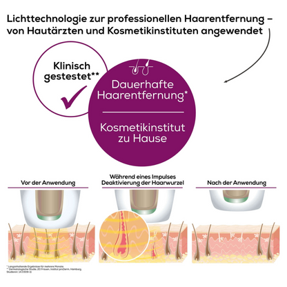 En tysk infografik om hårborttagningsteknologi med Beurer Permanent hårborttagning IPL VelvetSkinPro Black illustrerar processen före, under och efter användning. Texten betonar professionell permanent hårborttagning för hemmabruk, testad av hudläkare och kosmetikinstitut. Illustrationerna visar hårborttagningen.