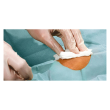 En närbild av handskbeklädda händer som rengör ett litet hudområde med en vit duk, omgiven av blågröna Hartmann Foliodrape® Protect håldukar, självhäftande, sterila, individuellt förpackade, från Paul Hartmann AG.